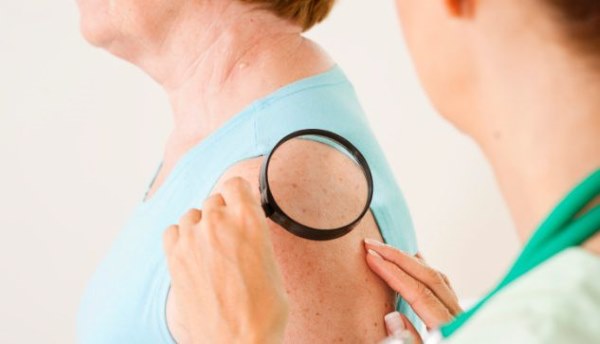 dermatolog-rak-koze